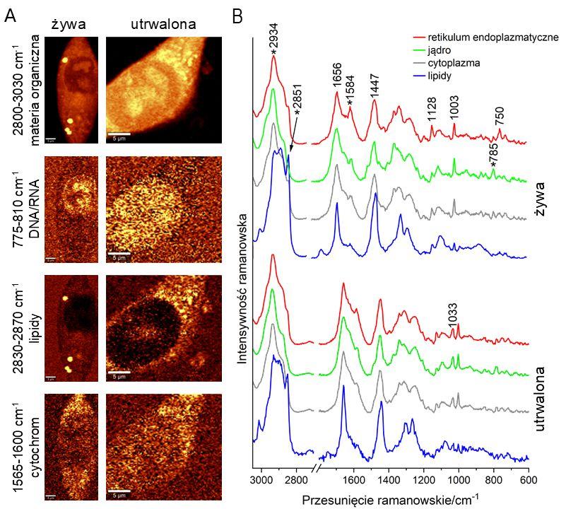 Zatrzymanie czasu w komórkach: mega-szczegółowe migawki procesów życiowych dzięki mikroskopii