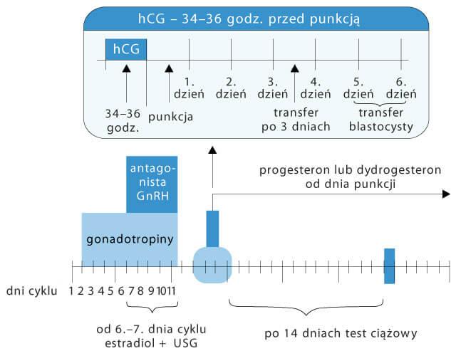 Biotechnologia IVF 2.0: AI + mikroflu­id­yka filtrują „gwiezdne plemniki” i mogą zwiększyć skuteczność procedur zapłodnienia in vitro